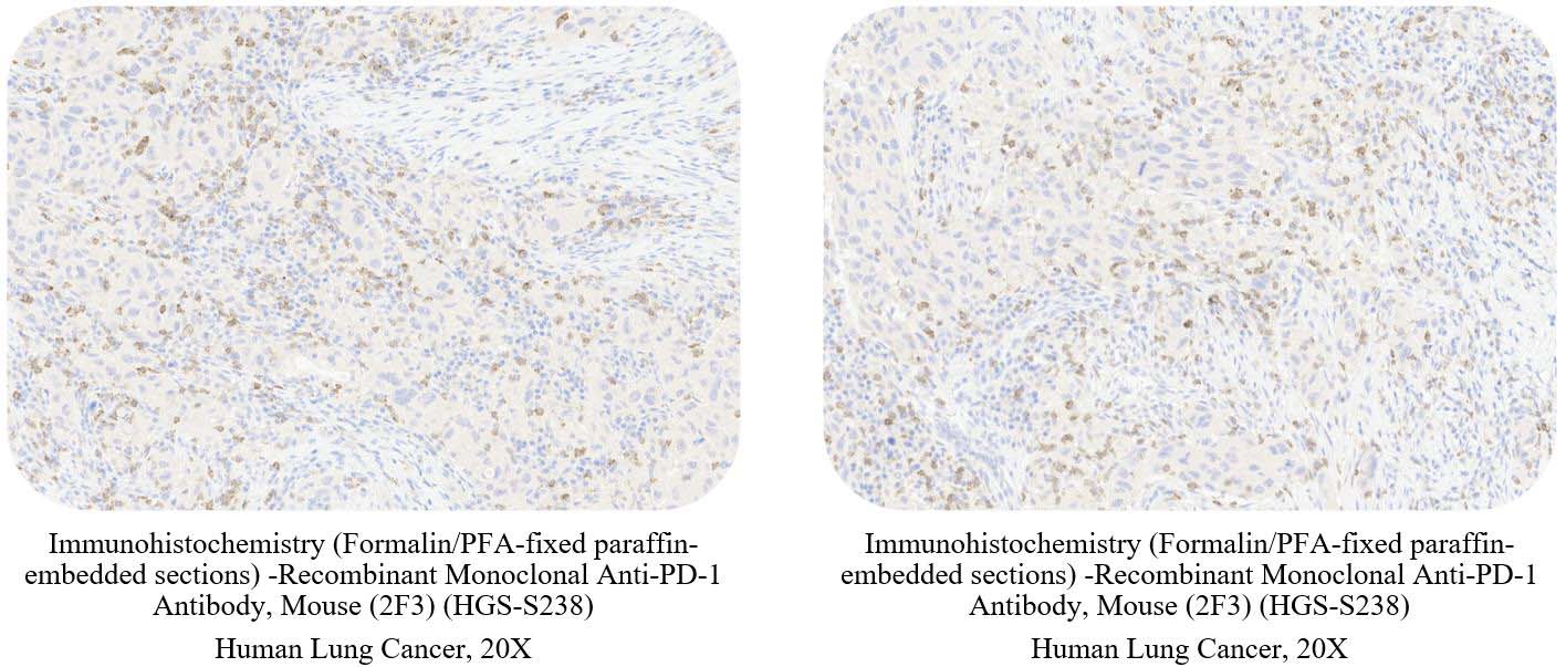 PD-1 CANCER SAMPLE