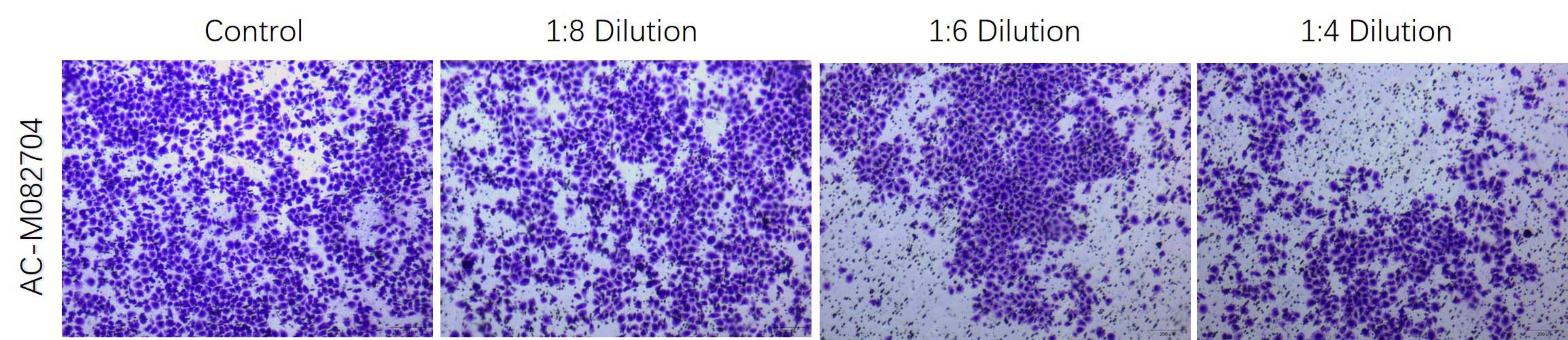 Mogengel TUMOR INVASION ASSAY