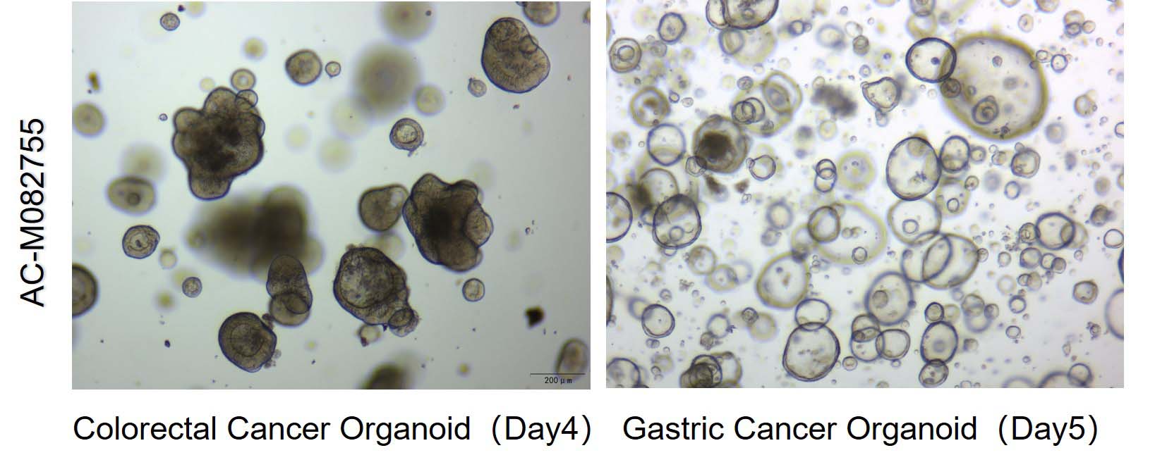 Mogengel TUMOR ORGANOID CULTURE