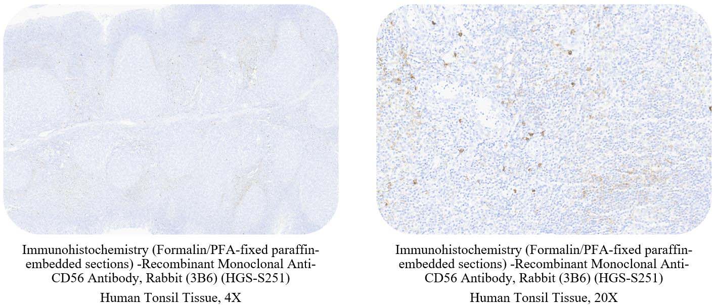 CD56 CONTROL SAMPLE