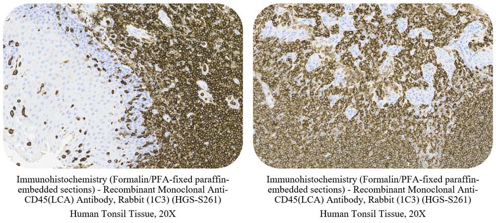 CD45 (LCA) CONTROL SAMPLE