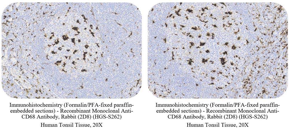 CD68 CONTROL SAMPLE