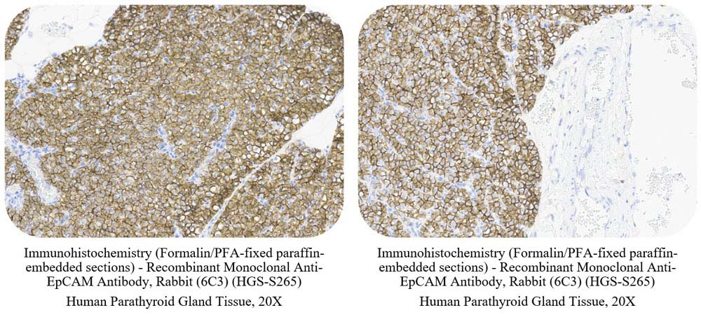 EpCAM CONTROL SAMPLE