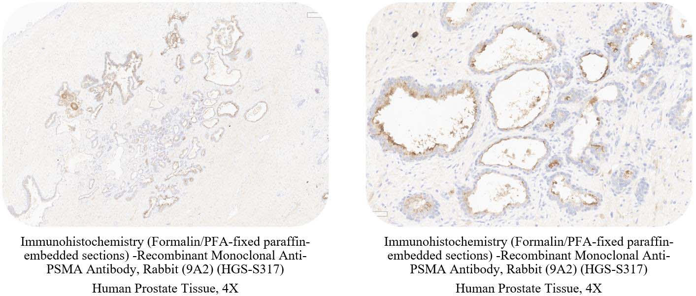 PSMA CONTROL SAMPLE