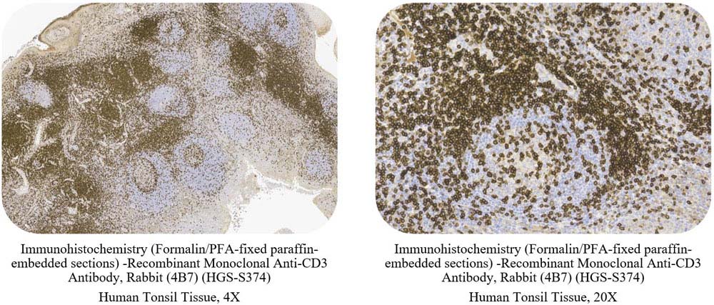 CD3 CONTROL SAMPLE