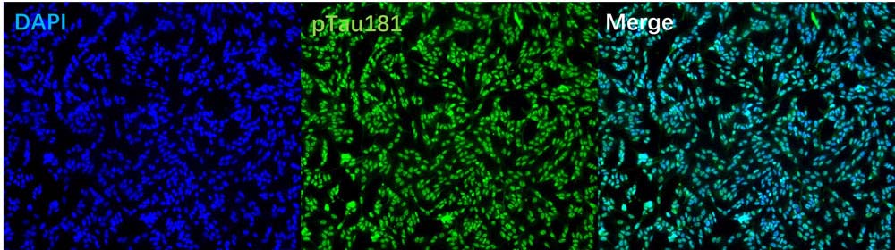 Tau IMMUNOFLUORESCENCE