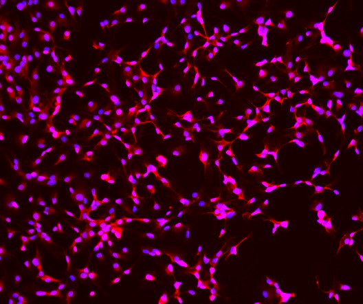 GFAP IMMUNOSTAINING