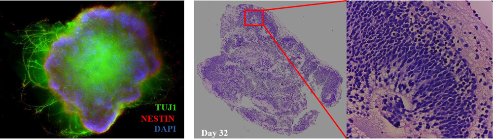 BDNF ORGANOID CULTURE