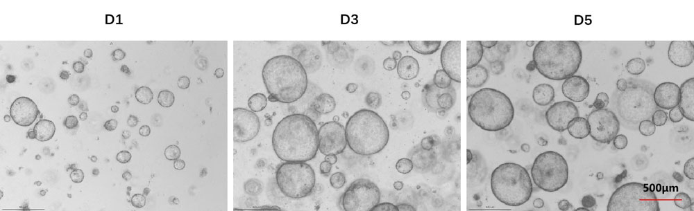 EGF ORGANOID CULTURE