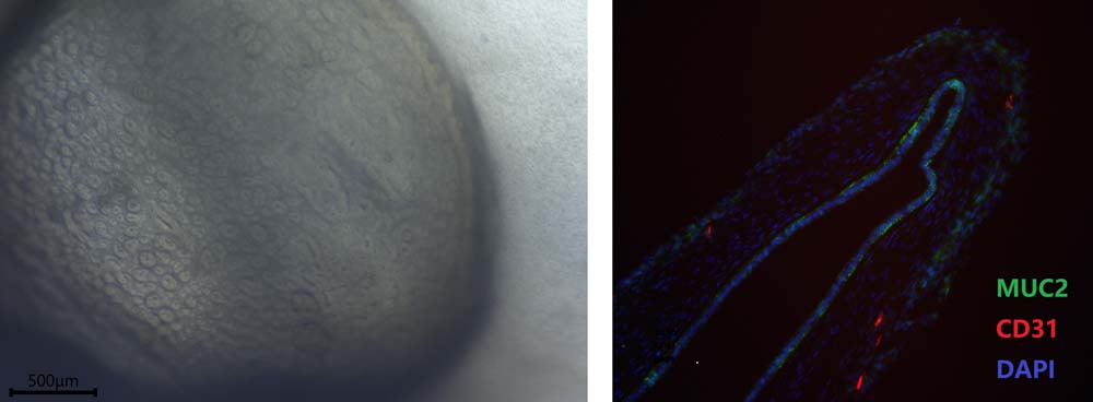 EGF ORGANOID CULTURE