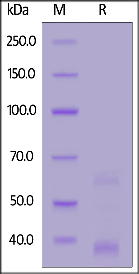 Human ADAM8, His Tag (Cat. No. AD8-H5223) SDS-PAGE gel