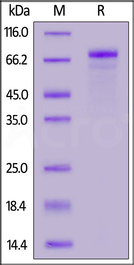 Human Cadherin-9, His Tag (Cat. No. CA9-H52H6) SDS-PAGE gel