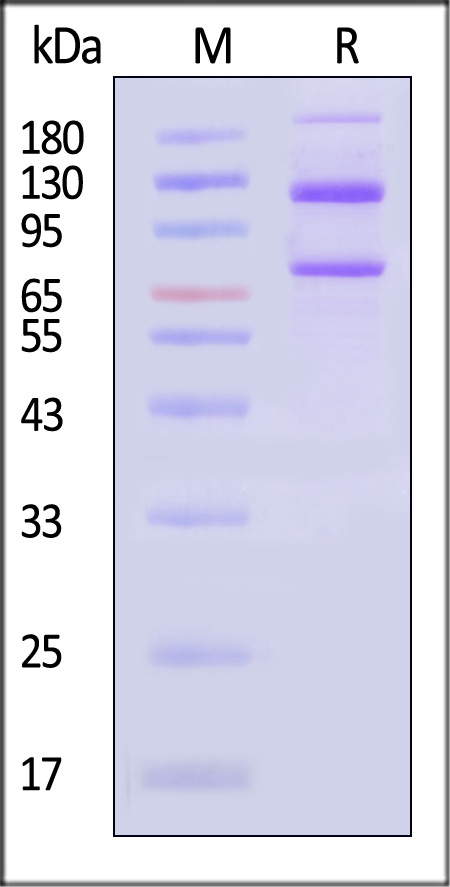 Complement C5 SDS-PAGE