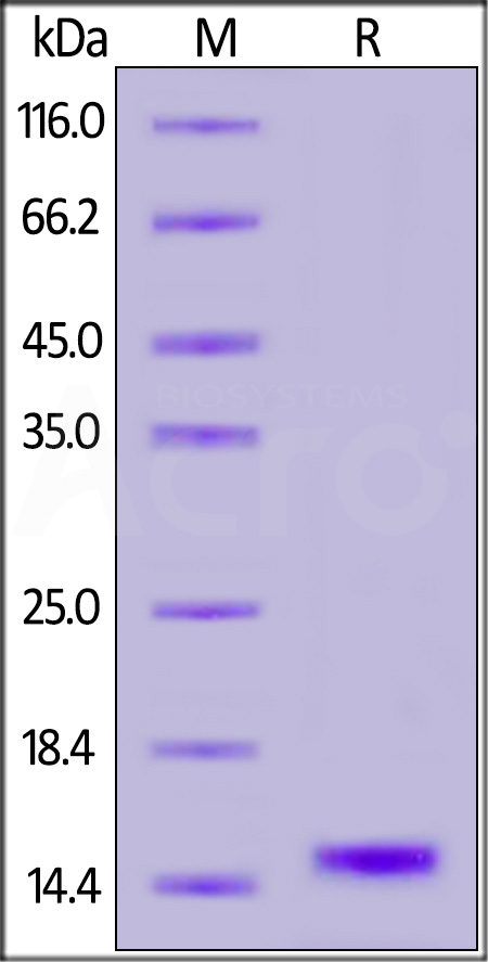 Cystatin S SDS-PAGE