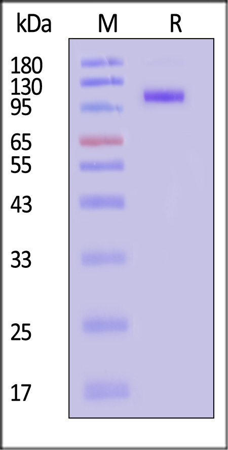 DPPIV SDS-PAGE