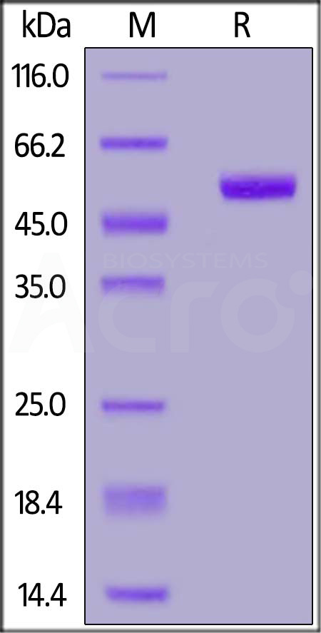 Human Frizzled-4, Fc Tag (Cat. No. FZ4-H5250) SDS-PAGE gel