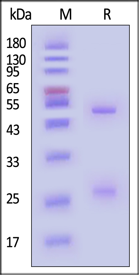 Hemagglutinin-neuraminidase/HN (MuV) SDS-PAGE