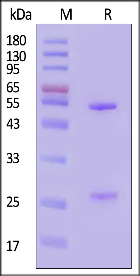 Fusion glycoprotein F0/F protein (RSV) SDS-PAGE