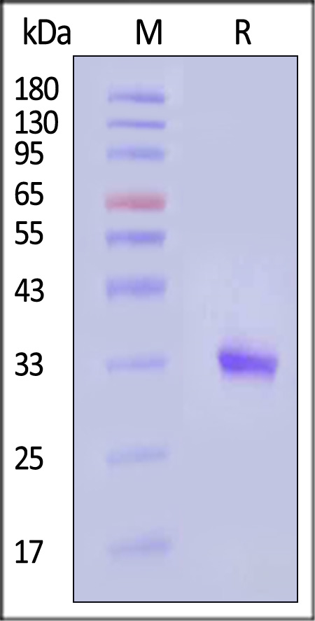 IGFBP-1 SDS-PAGE