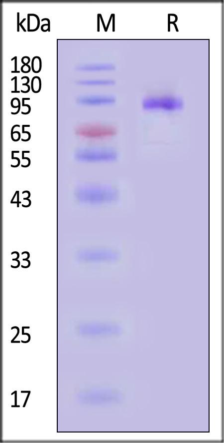 IL-12 R beta 2 SDS-PAGE