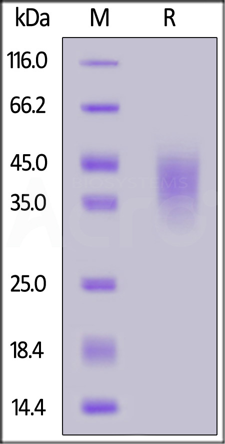 Mouse NKG2A, His Tag (Cat. No. NKA-M52H5) SDS-PAGE gel