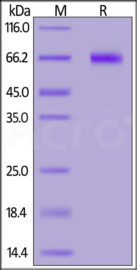 NOTCH1 SDS-PAGE