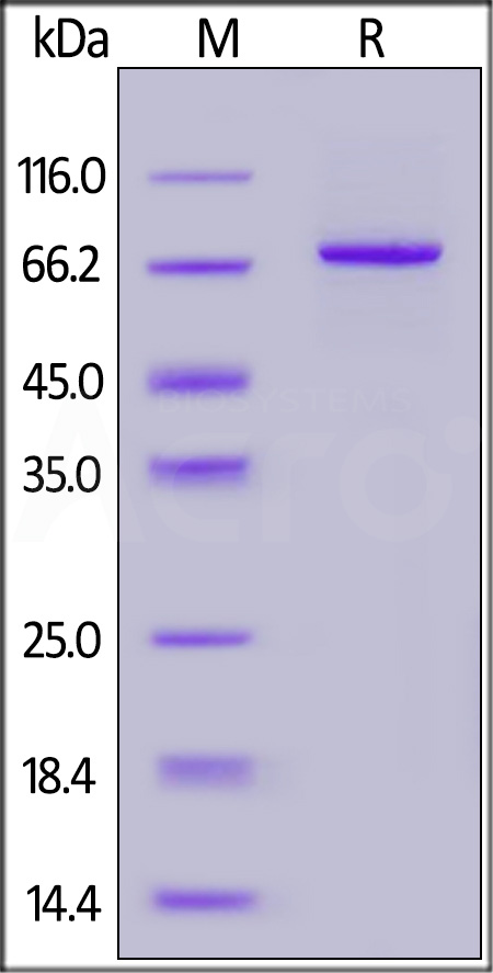 Human PADI2, His Tag (Cat. No. PA2-H5543) SDS-PAGE gel