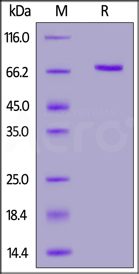 PADI2 SDS-PAGE