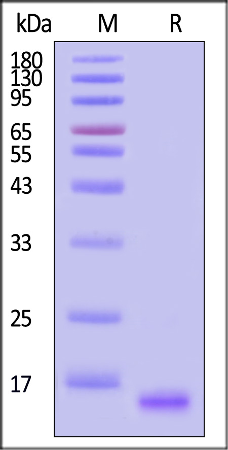 E7 SDS-PAGE