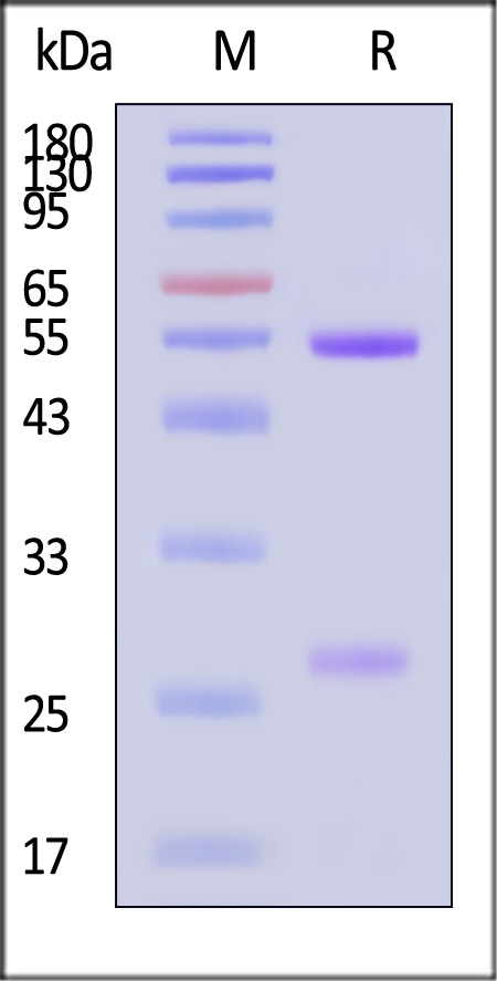 pre-Gc protein SDS-PAGE