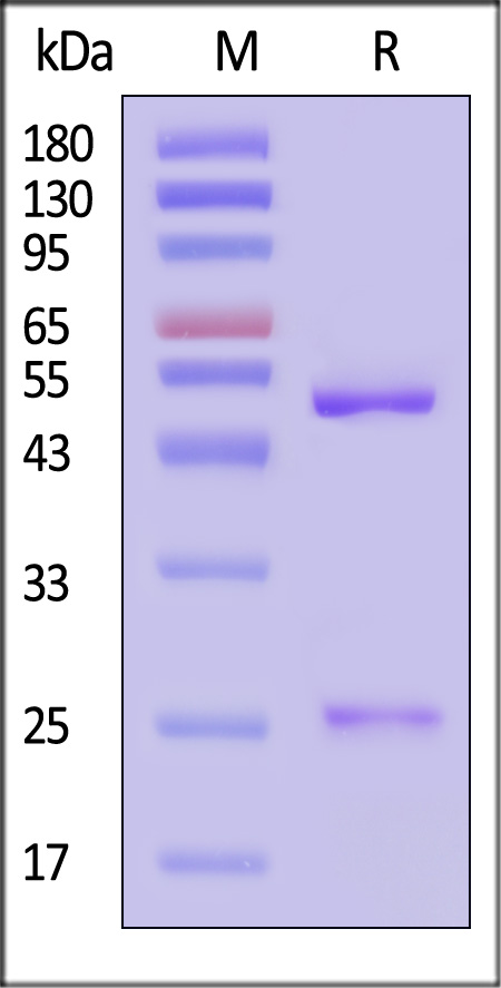 Tau SDS-PAGE