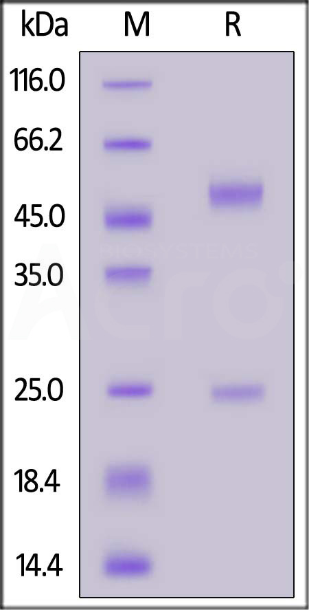 Rituximab SDS-PAGE