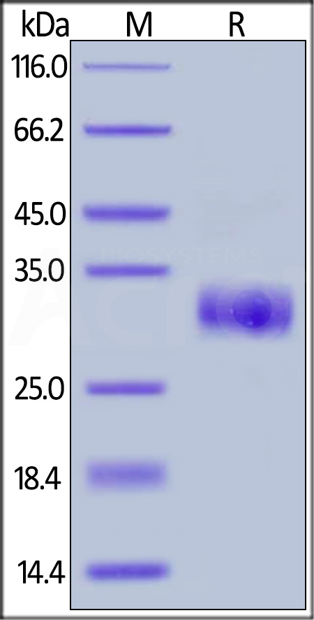 Human TIMP1, His Tag (Cat. No. TI1-H5226) SDS-PAGE gel