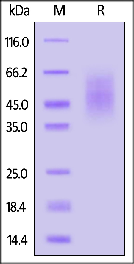 VP0 (Coxsackievirus A16) SDS-PAGE