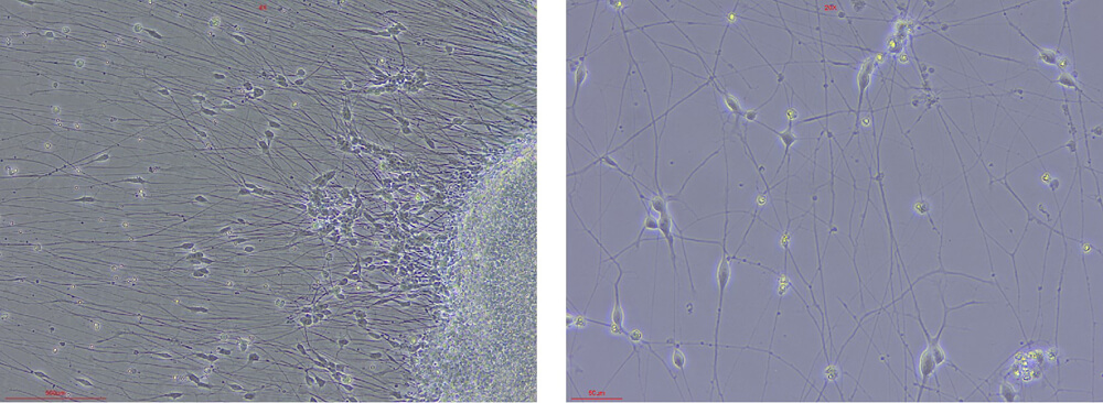 GDNF STEM CELL CULTURE