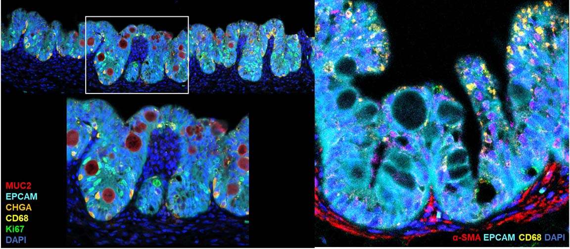 Organoids MARKER EXPRESSION