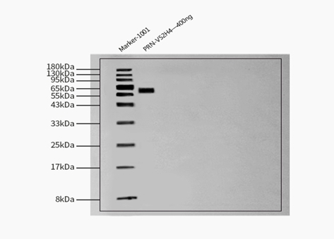 pre-Gc protein WESTERN BLOT