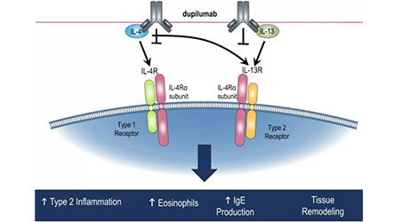 【靶点聚焦】IL-4 R alpha缘何成为潜在百亿市场药物靶点？
