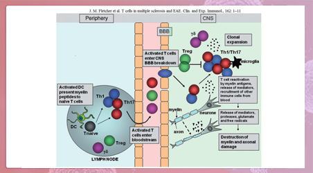 【前沿进展】【聚焦】多发性硬化症