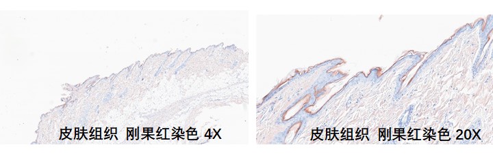 样本类型：含有淀粉样物质的组织，例如皮肤