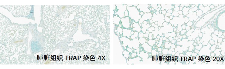 样本类型：肺组织或骨组织等含有抗酒石酸酸性磷酸酶的组织