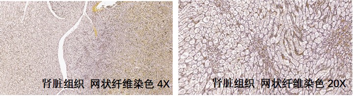 样本类型：肾组织等含有网状纤维的组织