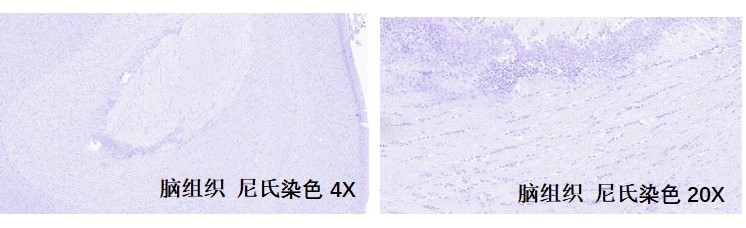 样本类型：脑等包含神经细胞的组织