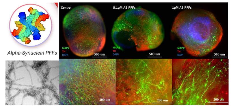 Alpha-synuclein Preformed fibril treatment on Cerebral organoid to model Parkinson’s disease