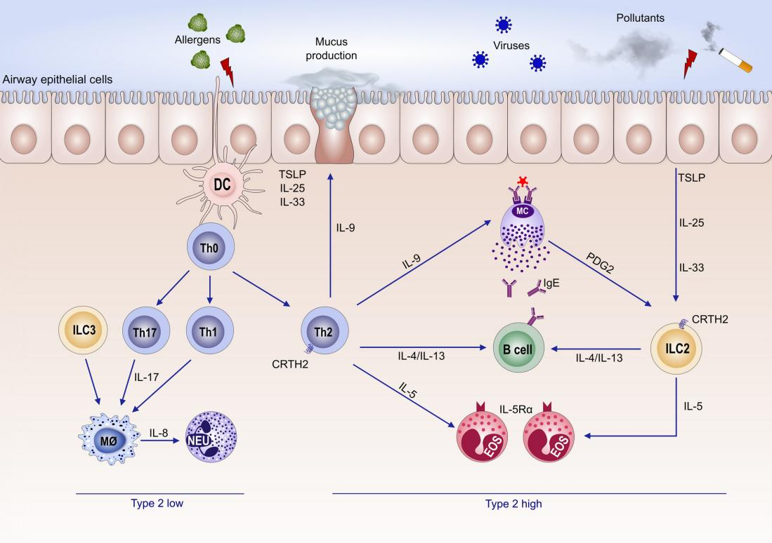 2型低度哮喘与2型高度哮喘的发病机制1