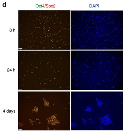 Immunostaining of HS181 hES cells for pluripotency markers Oct4 