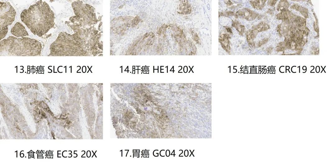 机构首发！完全自研PD-L1免疫组织化学检测方法（5D3）完整验证报告