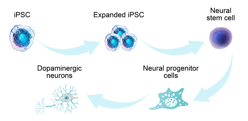 iPSCs分化为DNs的流程