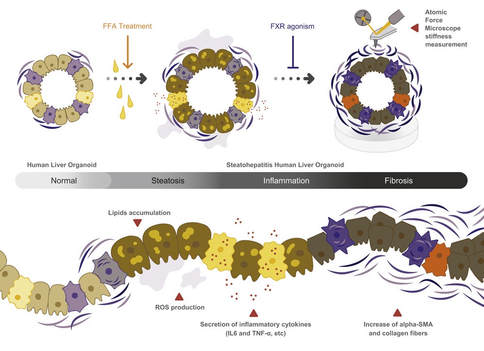 FFA处理下的肝脏类器官逐渐表现出NASH的关键特征